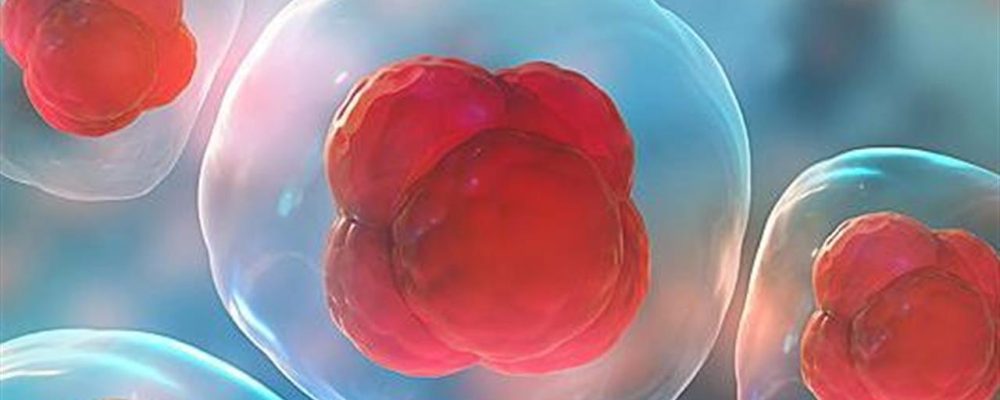 Θεραπεία με βλαστοκύτταρα: Πώς βάζει «φρένο» στην εξάπλωση και την ανάπτυξη των καρκινικών όγκων