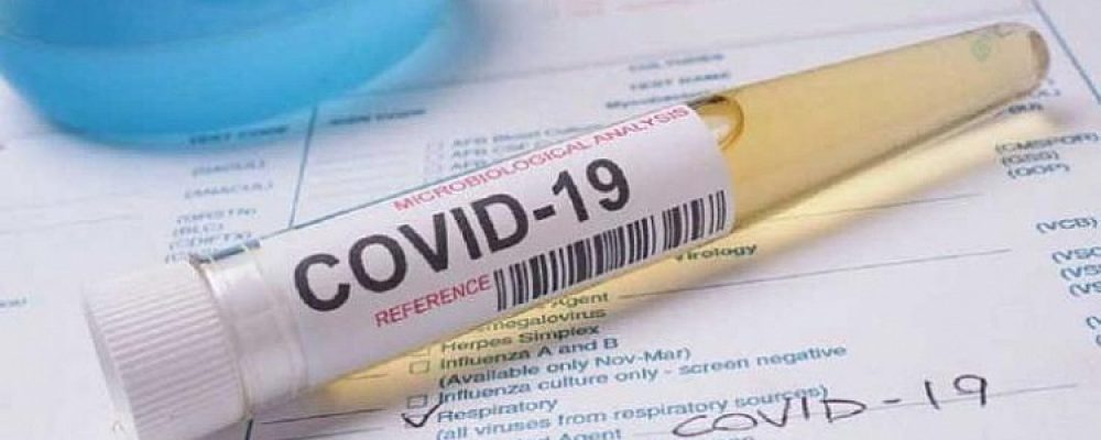 Όλα καλά…Κανένα νέο κρούσμα Covid-19 στην Κορινθία το τελευταίο 24ωρο