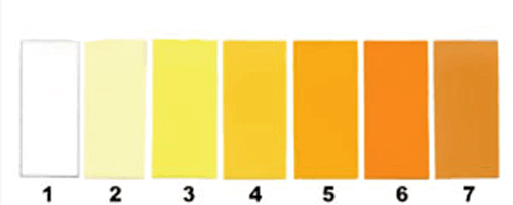 Τι δείχνει το χρώμα των ούρων για την υγεία σας (χρωματικός πίνακας)